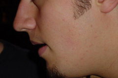 nose